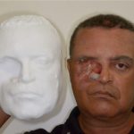 Первому человеку в мире сделали лицо с помощью 3D-печати.