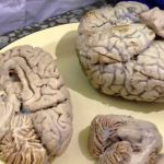 Почему мозг человека имеет извилистую форму?