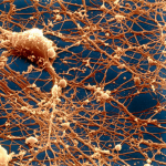 Обнаружены нейроны, поддерживающие сознание.